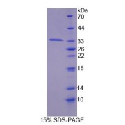 SDS-PAGE analysis of Mouse TAT Protein.