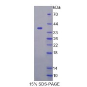 SDS-PAGE analysis of Human GFPT1 Protein.