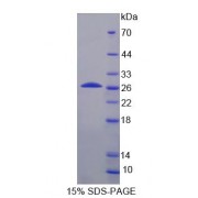 SDS-PAGE analysis of Human INSRR Protein.