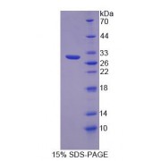 SDS-PAGE analysis of Mouse INSRR Protein.