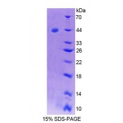 SDS-PAGE analysis of Human SYCN Protein.