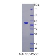 SDS-PAGE analysis of recombinant Human IRS4 Protein.