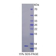 SDS-PAGE analysis of Human GTF2H5 Protein.
