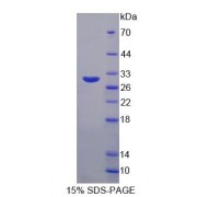 SDS-PAGE analysis of recombinant Human DPP3 Protein.