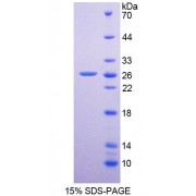 SDS-PAGE analysis of Human DPP6 Protein.