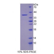 SDS-PAGE analysis of Human CNTNAP5 Protein.