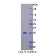 SDS-PAGE analysis of Rat TNFRSF25 Protein.