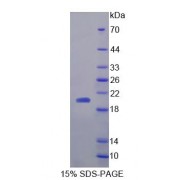 SDS-PAGE analysis of Human NT5C Protein.