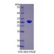 SDS-PAGE analysis of Rat NT5M Protein.