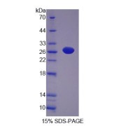 SDS-PAGE analysis of Rat NT5M Protein.