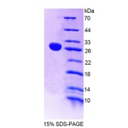 SDS-PAGE analysis of Human NT5C2 Protein.