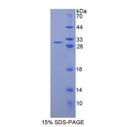 SDS-PAGE analysis of Rat NR0B1 Protein.