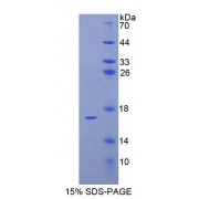 SDS-PAGE analysis of Human ELOB Protein.