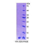 SDS-PAGE analysis of recombinant Human CALY Protein.