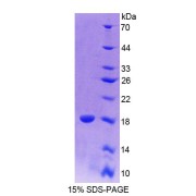 SDS-PAGE analysis of recombinant Mouse CALY Protein.