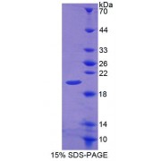 SDS-PAGE analysis of recombinant Rat CALY Protein.