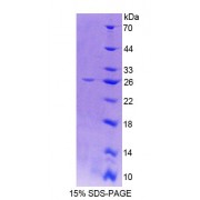 SDS-PAGE analysis of Human CTSO Protein.