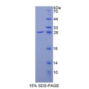 SDS-PAGE analysis of Mouse GPX6 Protein.