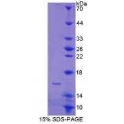 SDS-PAGE analysis of Mouse CABP2 Protein.