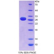 SDS-PAGE analysis of Human EFNA3 Protein.