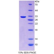 SDS-PAGE analysis of Human PCSK1 Protein.