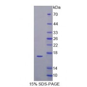 SDS-PAGE analysis of Mouse CDKN2B Protein.