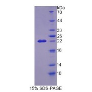 SDS-PAGE analysis of Mouse CDKN2D Protein.