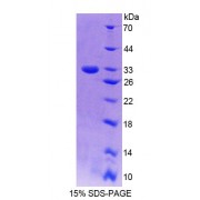 SDS-PAGE analysis of Human GBP6 Protein.