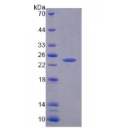 SDS-PAGE analysis of Rat RIPK1 Protein.