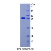 SDS-PAGE analysis of Mouse MCM3 Protein.