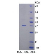 SDS-PAGE analysis of Human CDC16 Protein.