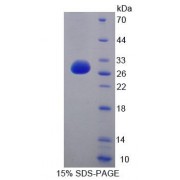 SDS-PAGE analysis of Human CDC27 Protein.