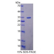 SDS-PAGE analysis of Mouse UBE2S Protein.