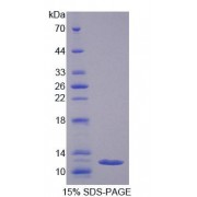 SDS-PAGE analysis of Human REG3G Protein.