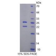 SDS-PAGE analysis of Human SPHK2 Protein.
