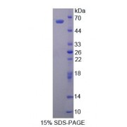 SDS-PAGE analysis of recombinant Human ALDH1A1 Protein.