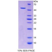 SDS-PAGE analysis of Human ALDH1A2 Protein.