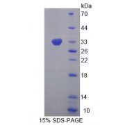SDS-PAGE analysis of Human EIF2S1 Protein.