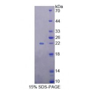 SDS-PAGE analysis of Human EEF1e1 Protein.