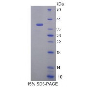 SDS-PAGE analysis of Human EEF1d Protein.