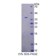 SDS-PAGE analysis of Mouse EEF1d Protein.