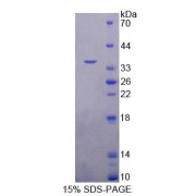 SDS-PAGE analysis of Human TRIM5 Protein.