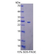 SDS-PAGE analysis of Mouse BAG5 Protein.