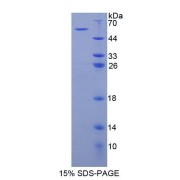 SDS-PAGE analysis of Human BAI3 Protein.