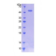 SDS-PAGE analysis of recombinant Mouse CACNa1H Protein.