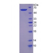 SDS-PAGE analysis of Human CAPN6 Protein.