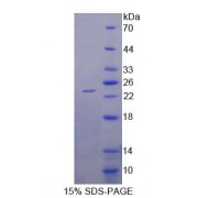 SDS-PAGE analysis of Human DPEP2 Protein.