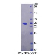 SDS-PAGE analysis of Human EXOC3 Protein.