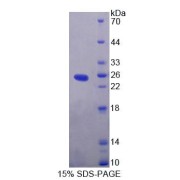 SDS-PAGE analysis of Human EXOC3 Protein.
