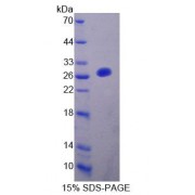 SDS-PAGE analysis of Rat FBLN7 Protein.